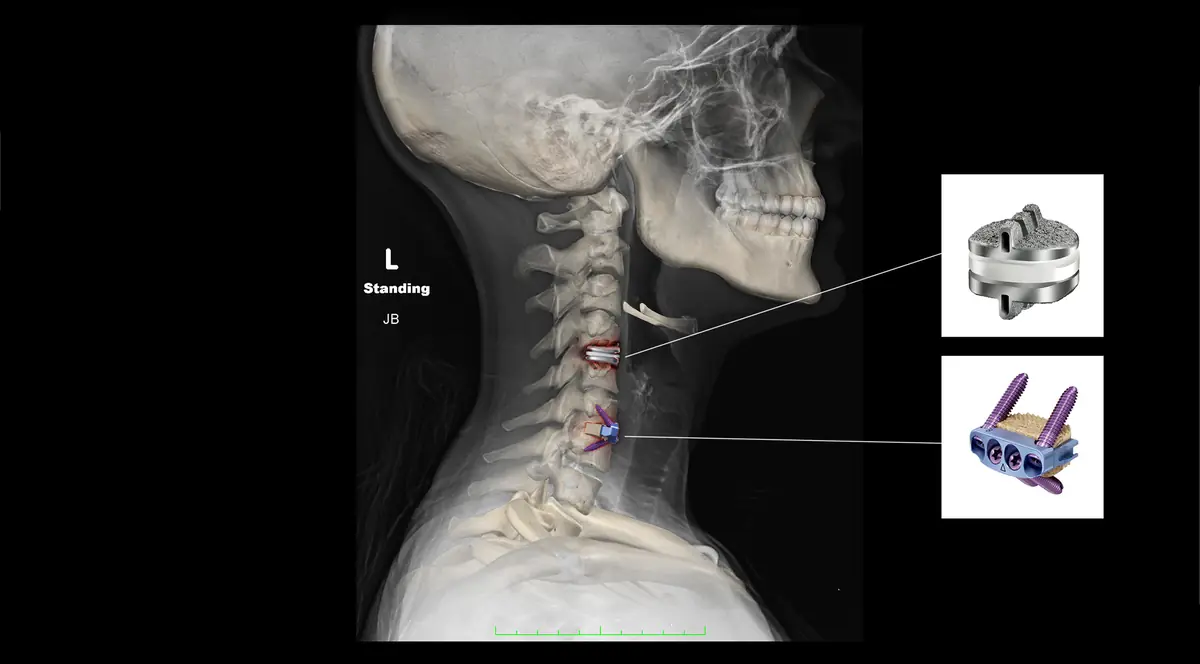 Medical Illustration
& colorization